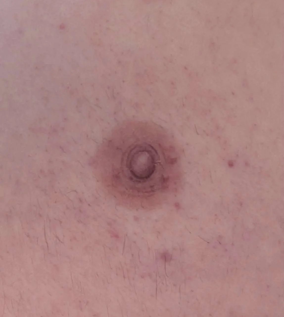 Close-up of a nipple tattoo on the chest with surrounding skin, some hair, and slight redness.