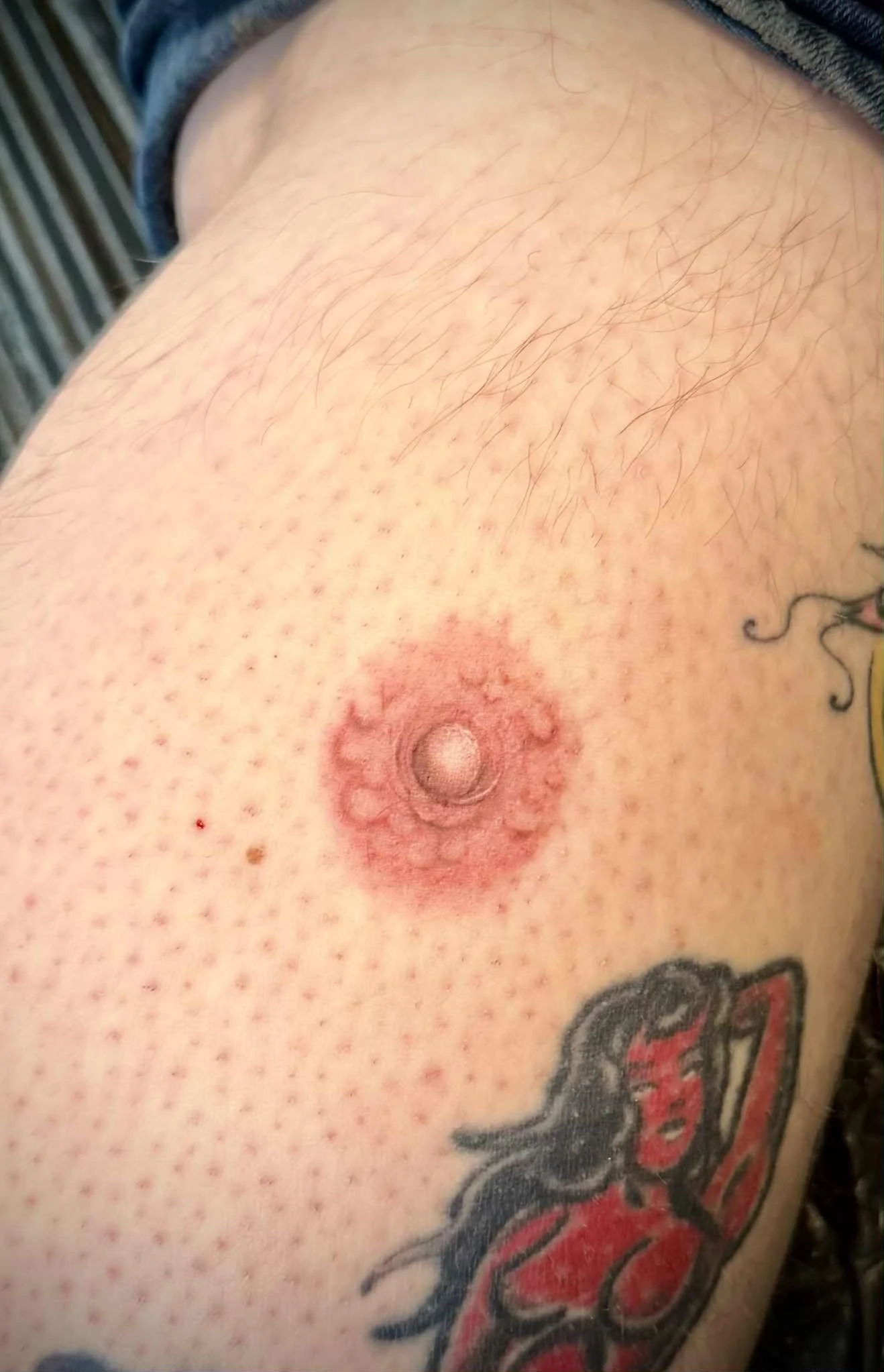 Close-up of a tattooed person's chest with a nipple, showing redness around the nipple, some hair, and tattoos including a red and black illustration of a woman.
