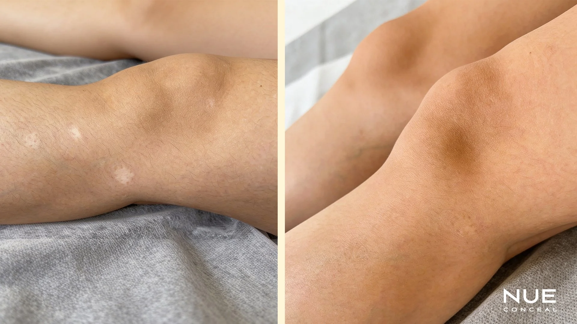 Leg scan camouflage tattoo revision