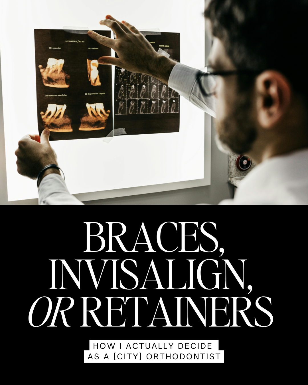 Braces, Invisalign,  or Retainers 