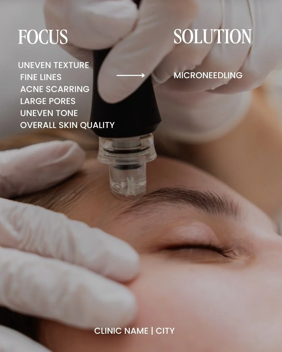 Focus - Solution