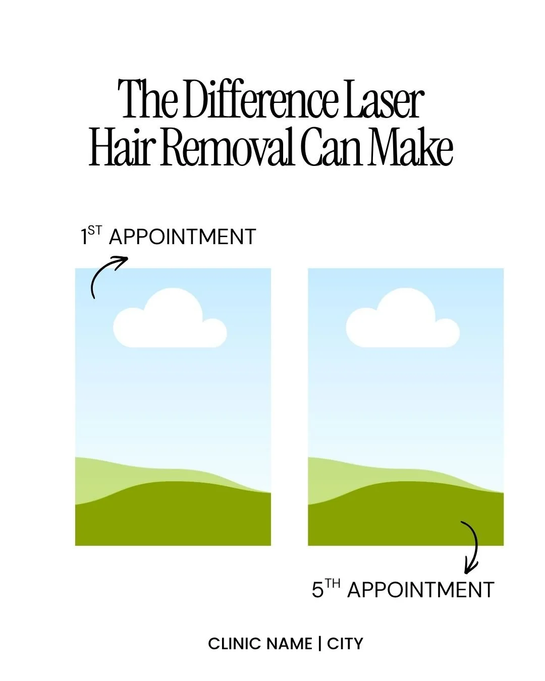 The Difference Laser Hair Removal Can Make