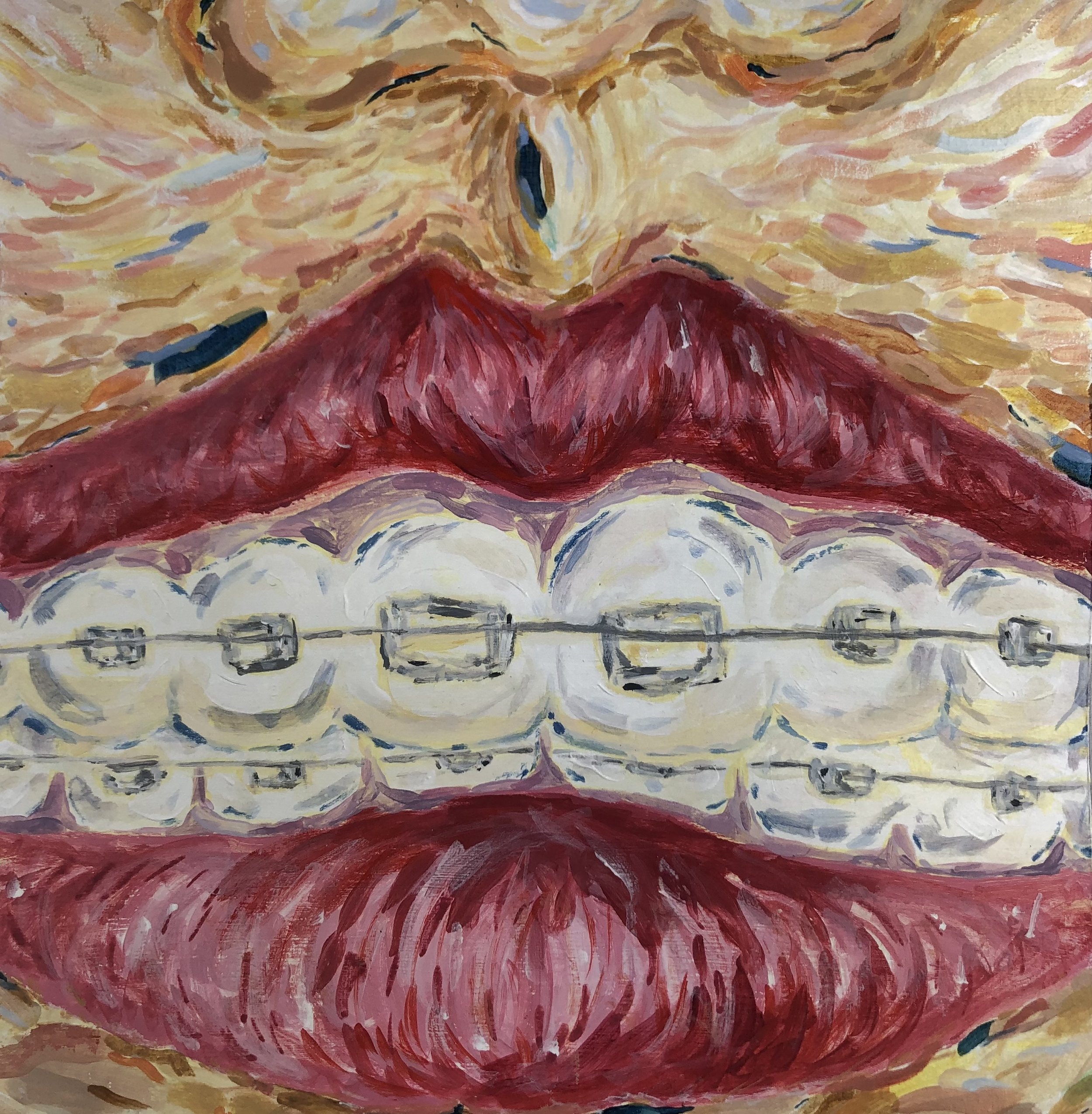 Braces Acrylic Painting.JPG