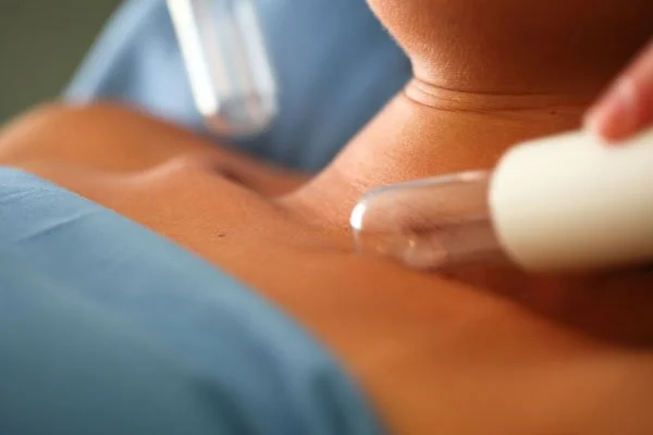 lymphstar example pic.jpg