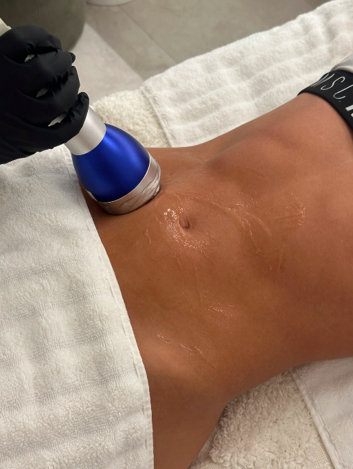 A person receiving a non-invasive body contouring or skin tightening treatment with a handheld device on their abdomen. The person is lying down on a white towel, and the technician is wearing black gloves.