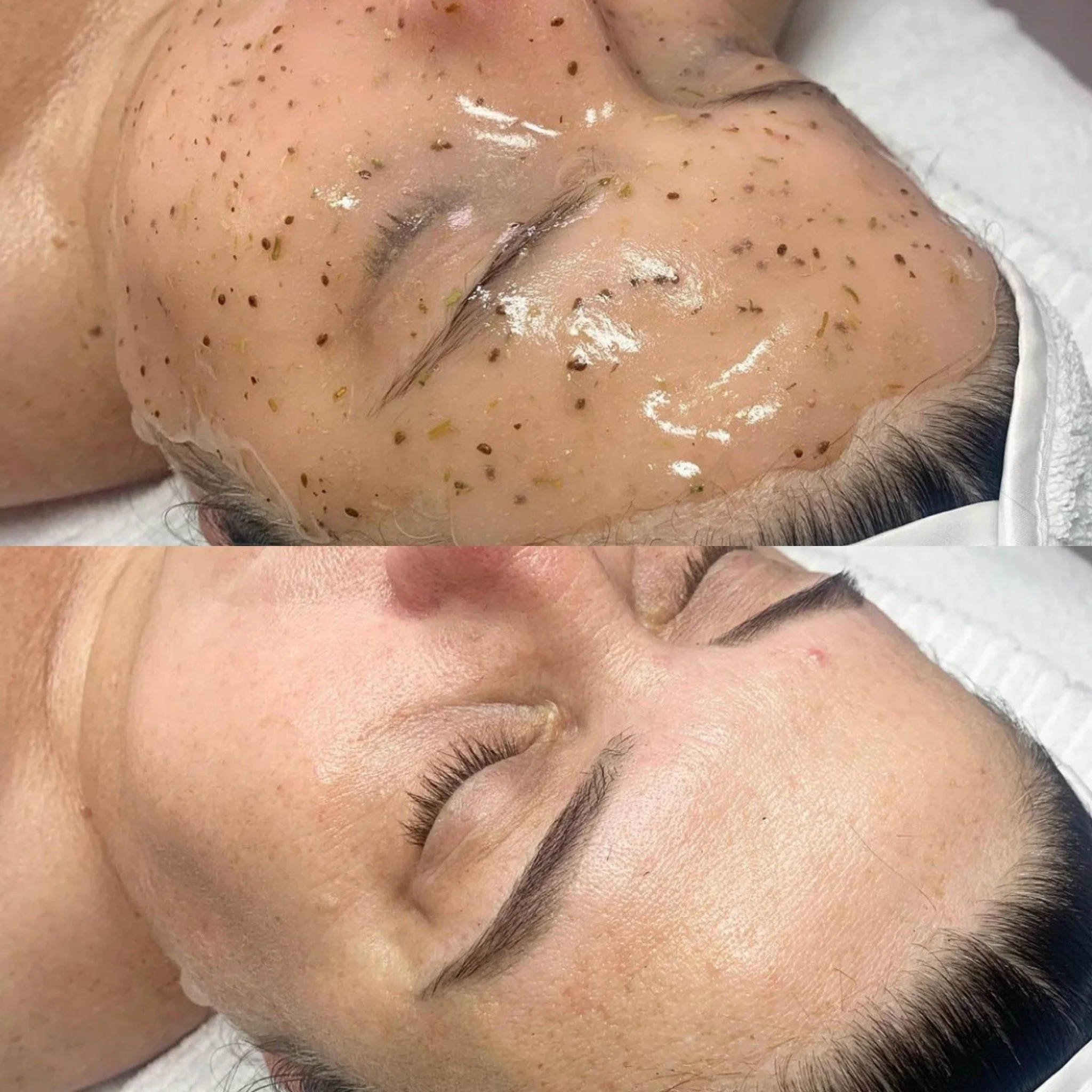 Before and after images of a woman's face showing the results of a facial treatment. The top image shows her face with visible blackheads and clogged pores, while the bottom image shows her skin clear, smooth, and refreshed.