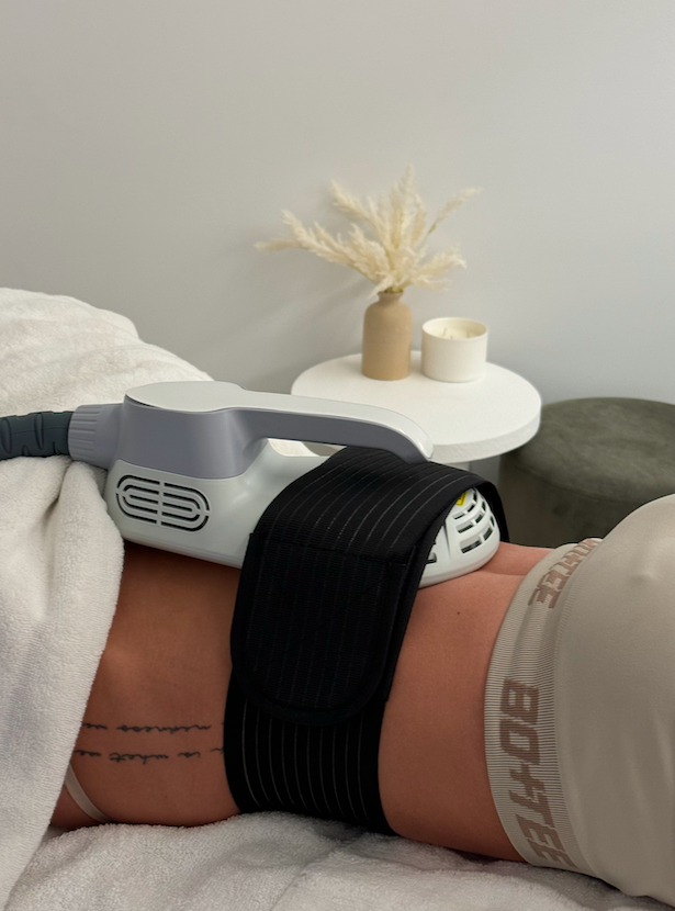 Person receiving a transcutaneous electrical nerve stimulation (TENS) therapy on their lower abdomen using a device with black straps.