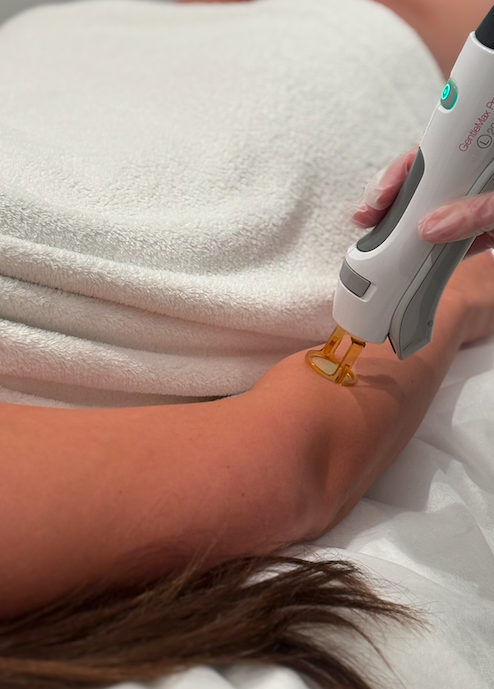 A person receiving a medical procedure with a device on their forearm, held by a healthcare professional, in a clinical setting.