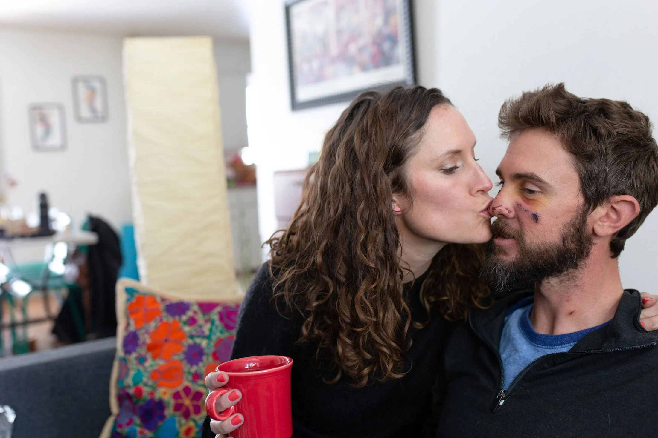 A woman kissing a man's nose with a bruise on his face, holding a red mug, sitting on a couch with colorful pillows in a cozy living room.