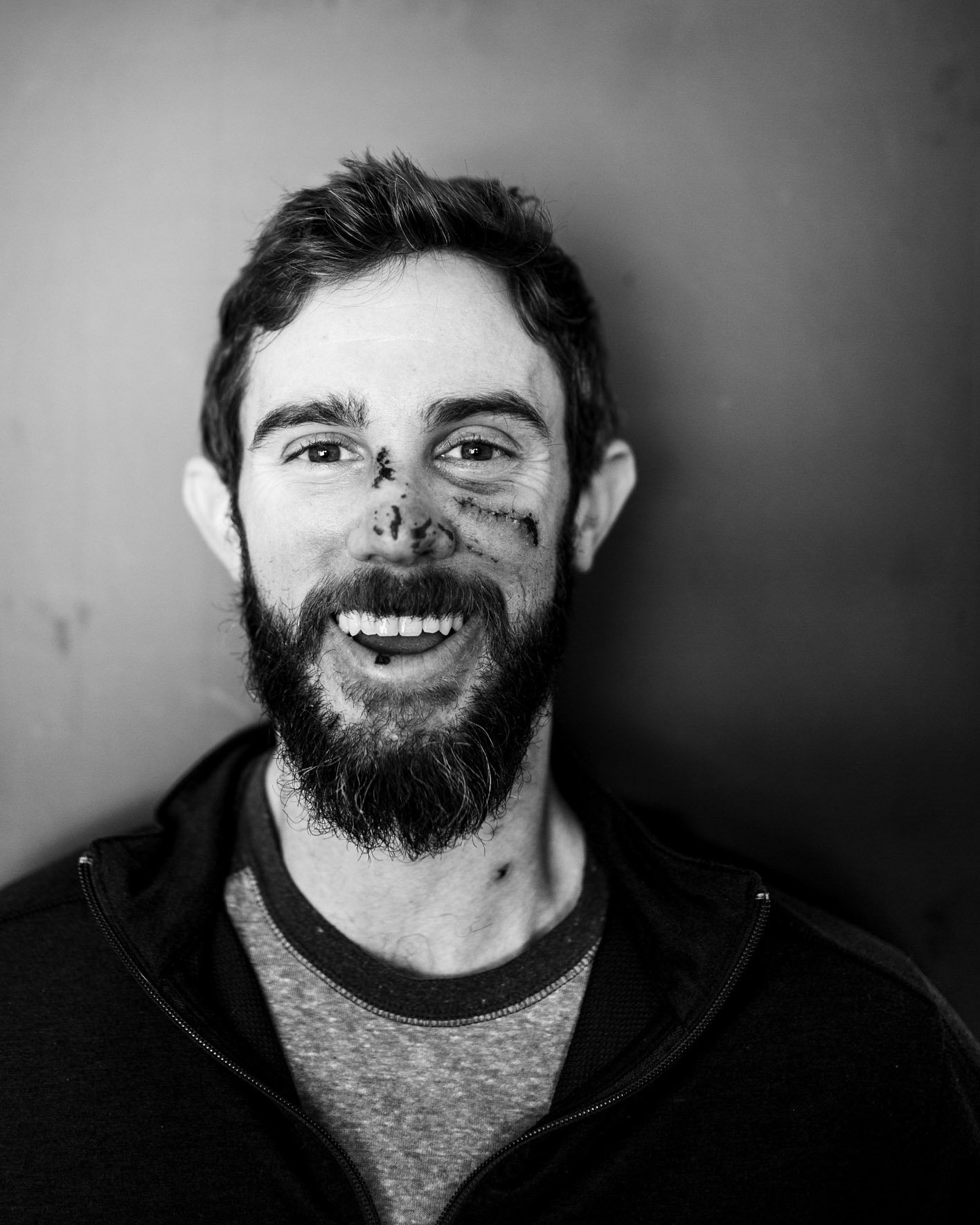 Black and white photo of a smiling man with a beard, wearing a zip-up jacket over a t-shirt, with some cuts and bruises on his face, standing against a plain wall.