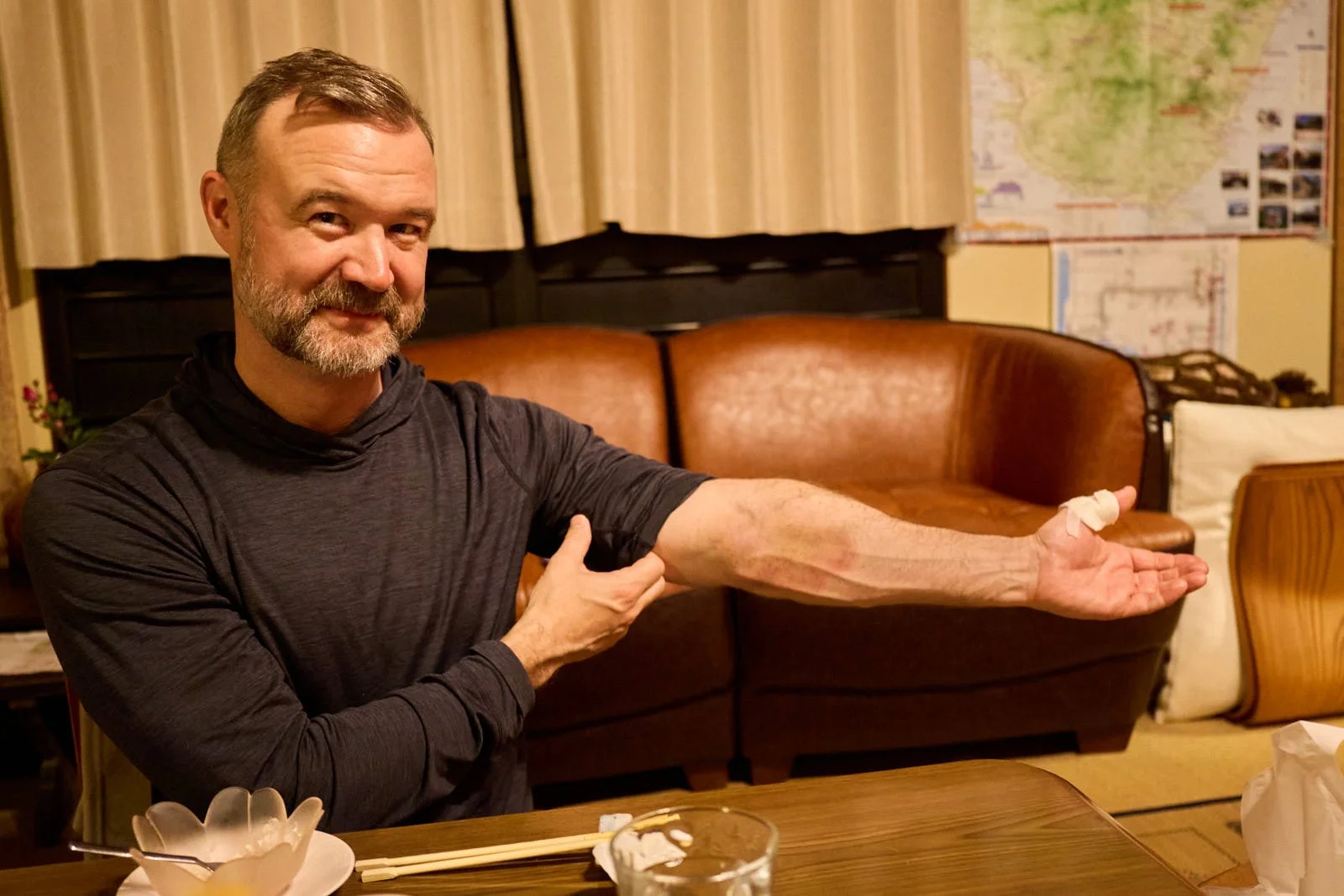 A man with a beard, wearing a black athletic shirt, is showing his left arm with a white bandage on his hand. He is seated at a table in a cozy, living room with warm lighting, and a leather sofa with a map on the wall behind him.