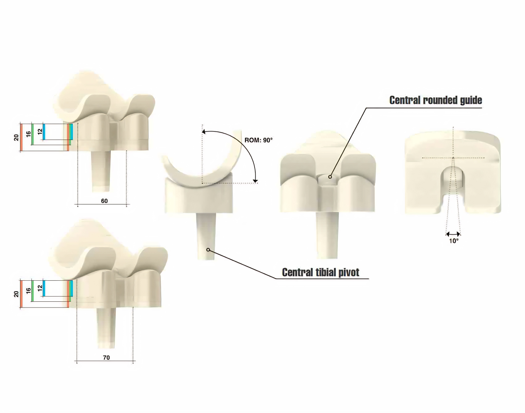 *3 distancias medio-laterales (M/L): 60, 70 y 80mm, por decidir al pedir el SpaceFlex Knee;
*3 Grosor de placa tibial (12, 16, 20 mm) que se decidirá durante la cirugía.