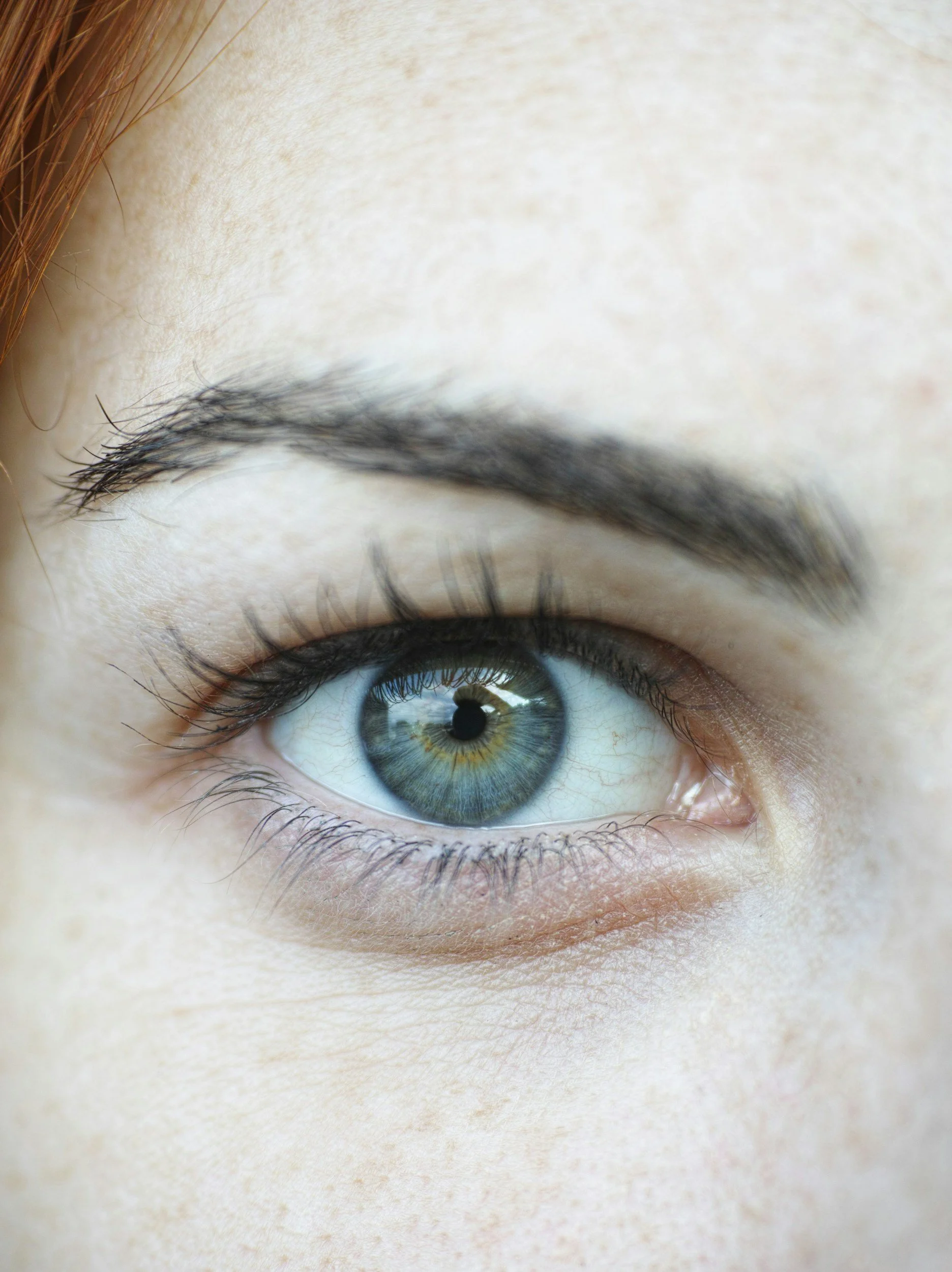Close-up of a human eye with a blue iris and healthy conjunctiva, no pterygium is visible.