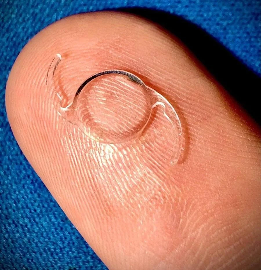 Close-up of a finger with a small intraocular lens (IOL) that would be implanted during cataract surgery