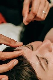 What actually happens in a  Fertility Acupuncture session?