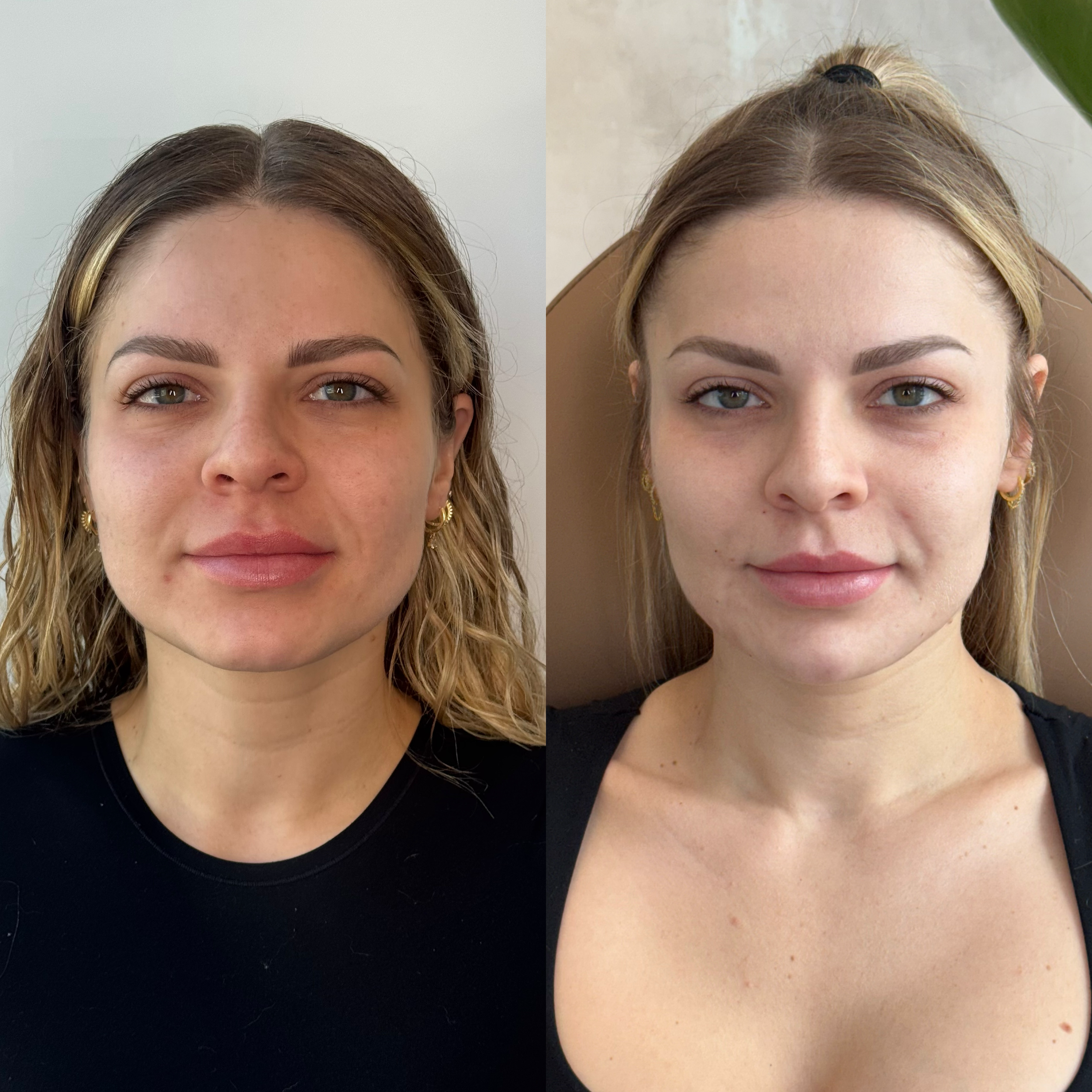 Side-by-side comparison of a woman's face before and after skincare or makeup, showing clearer skin and more defined features in the after photo.