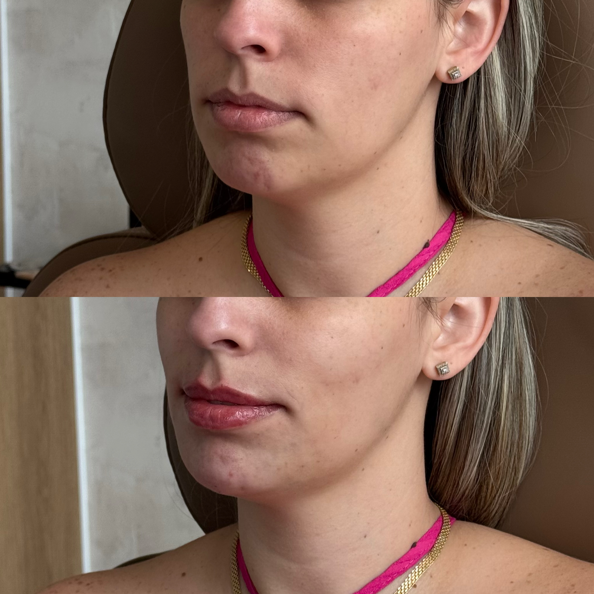 Close-up of a woman's face and neck before and after makeup application, showing smoother skin, enhanced lips, and overall improved appearance.