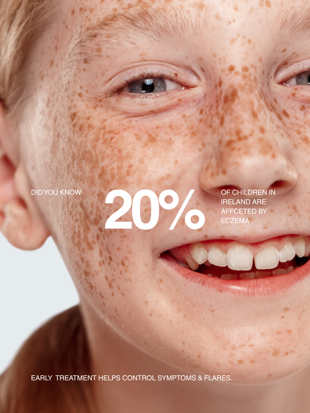 freckles, eczema