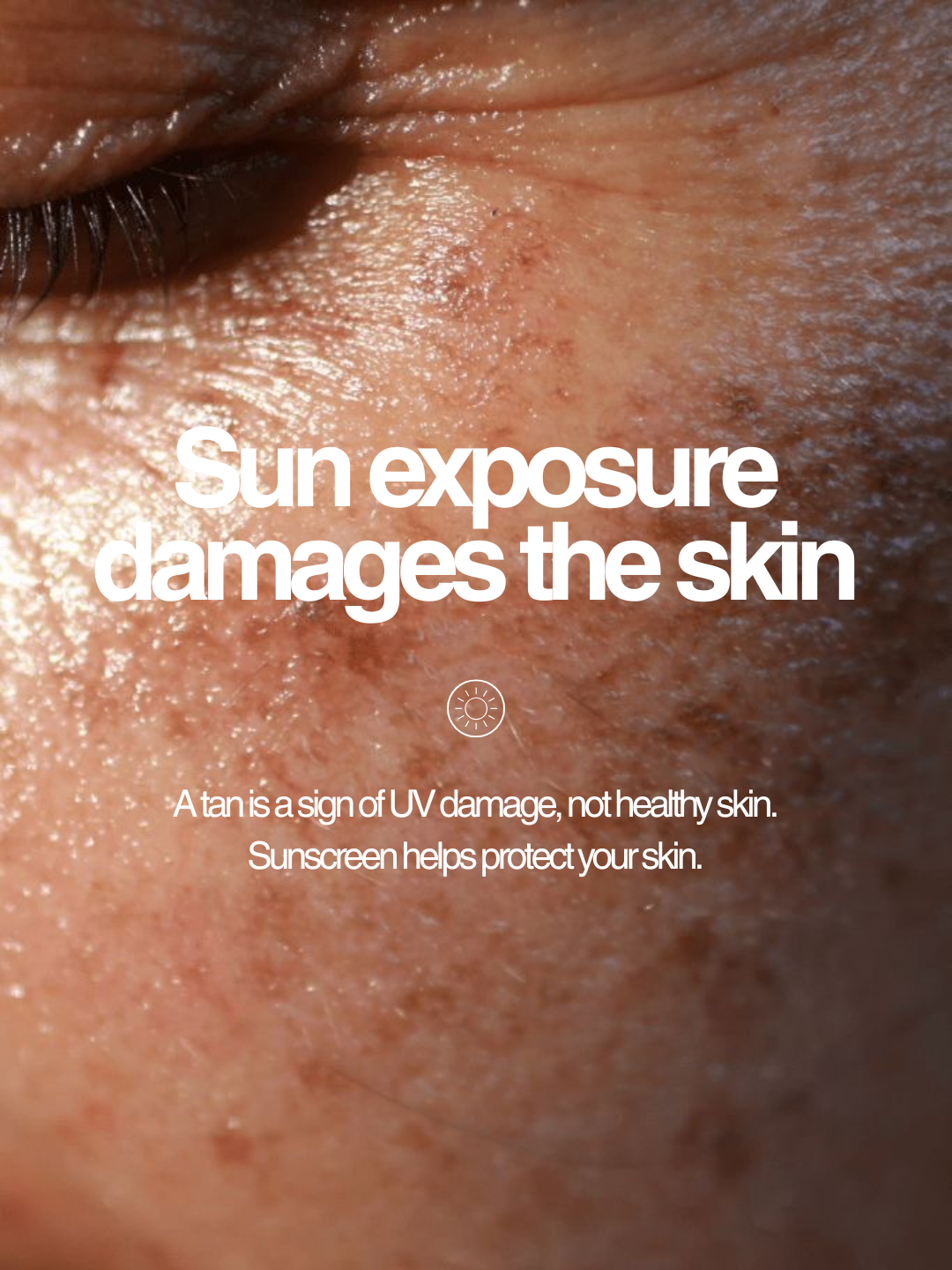sun-damaged skin with text warning about UV damage and sun protection.