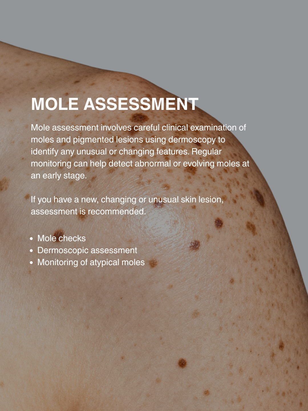 moles, orange and brown freckles, and pigmented lesions, illustrating mole assessment.