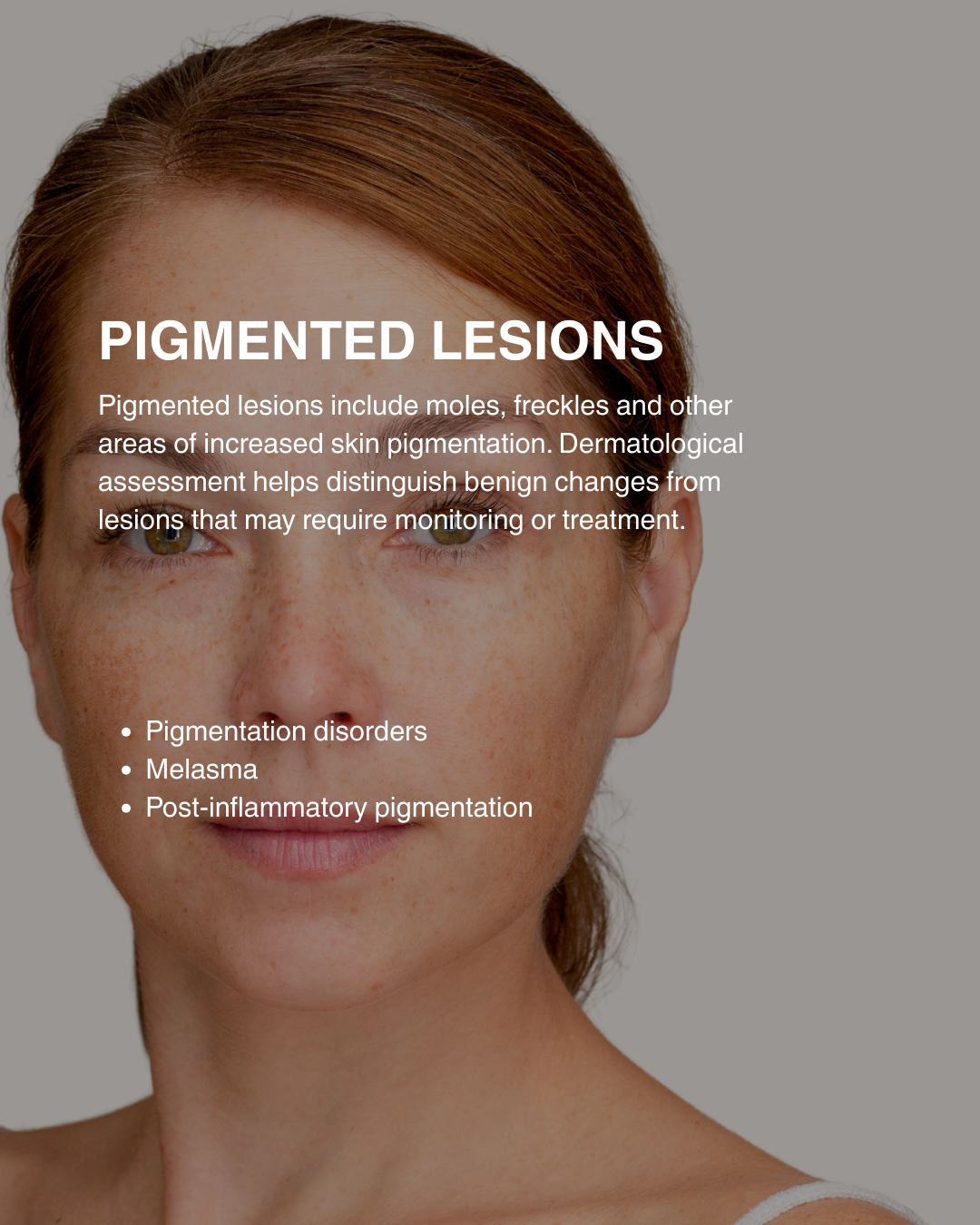 Dr Catriona Gallagher Dermatology - 42.png