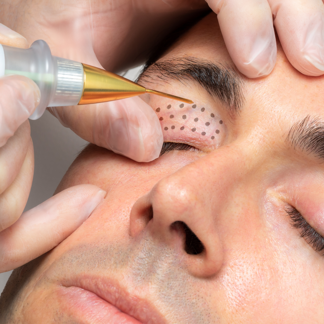 Medspa in Scottsdale, AZ, 85251 | Plasma Pen Near Me