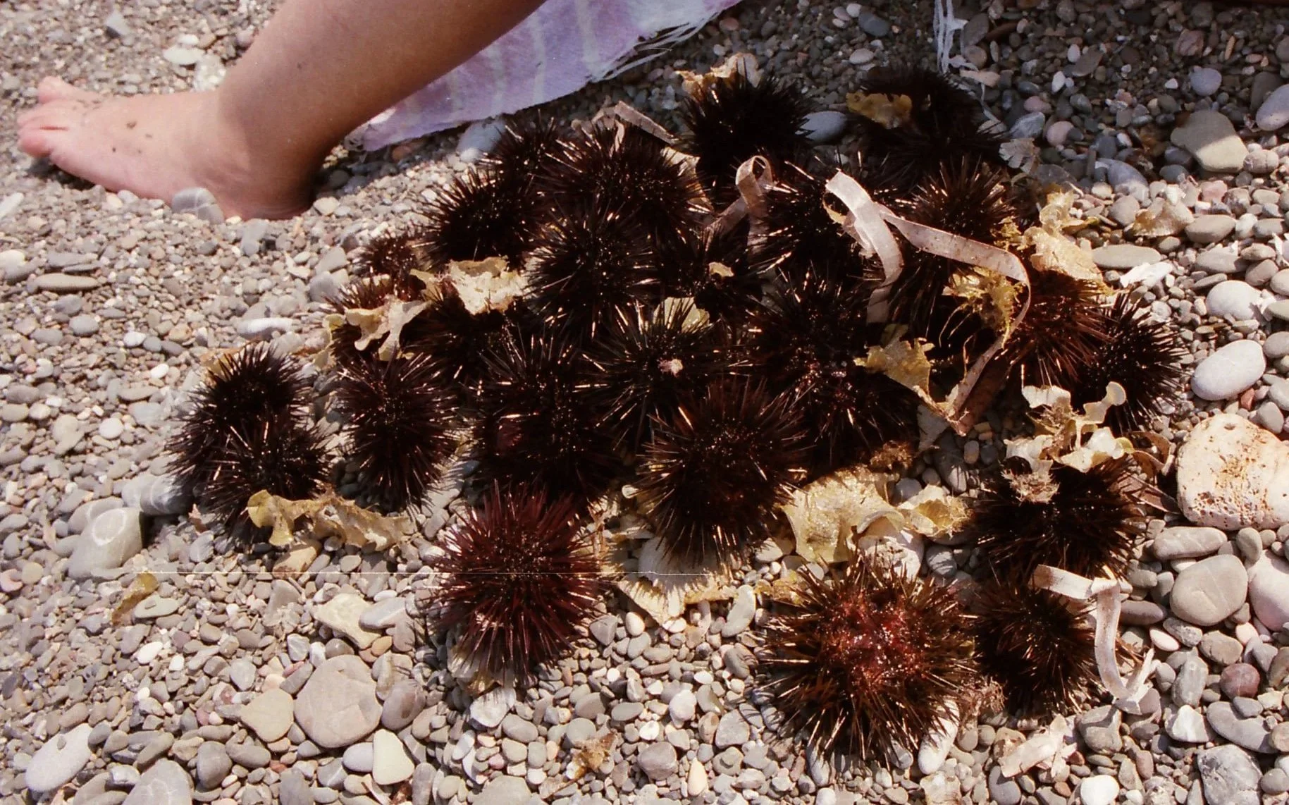 Sea urchins gathered on a pebbled beach beside sunlit skin and towel, capturing coastal textures and natural marine elements in a Mediterranean setting.