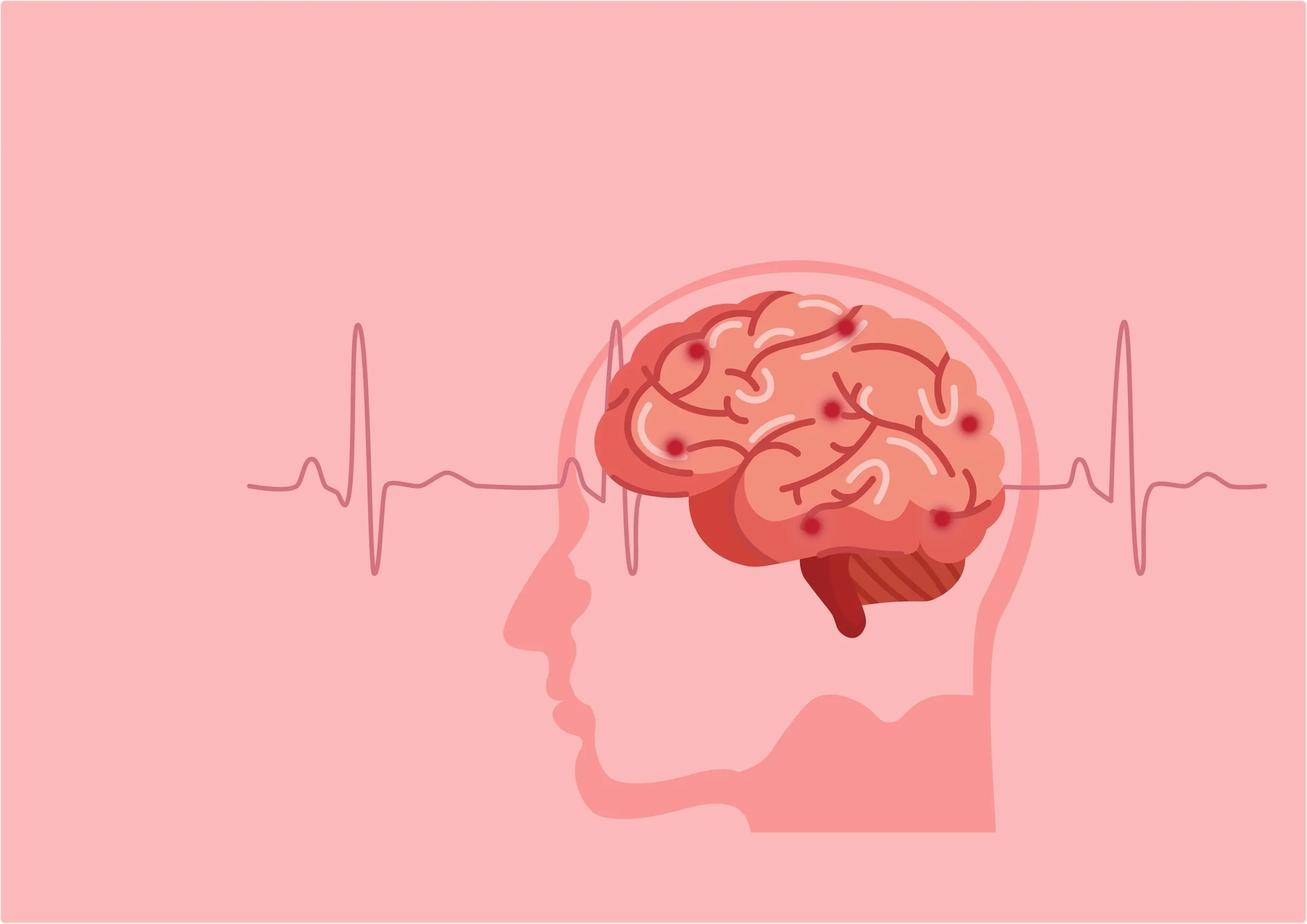Stroke Awareness & Prevention