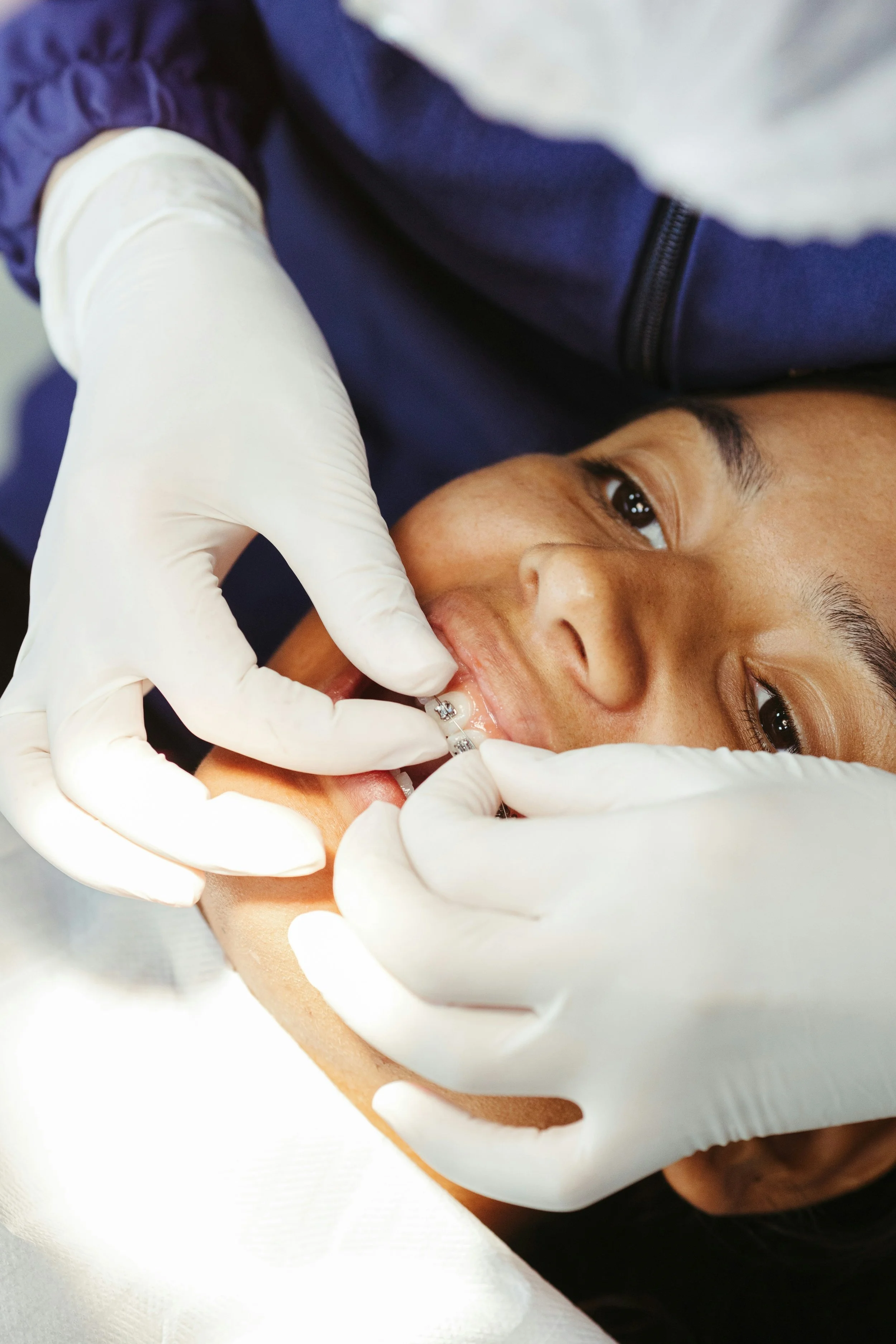 A person receiving dental care, with a close-up view of the dental procedure being performed by a healthcare professional wearing white gloves. The person is lying back, and the healthcare professional is working inside their mouth.