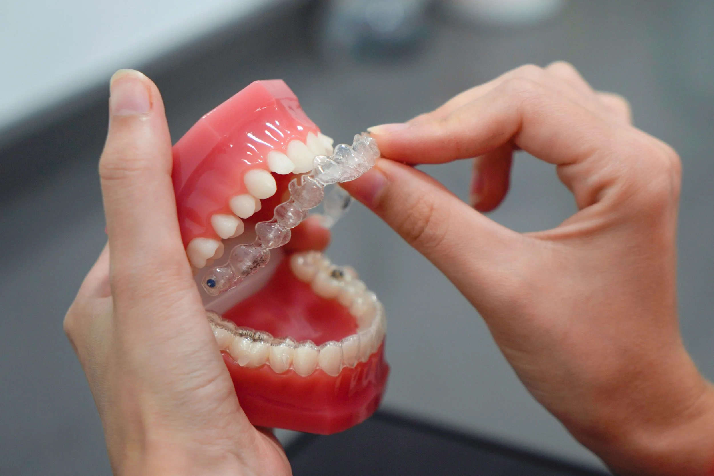 A clear aligner tray and a dental model with braces, compared at Beth&rsquo;s Braces in Las Vegas