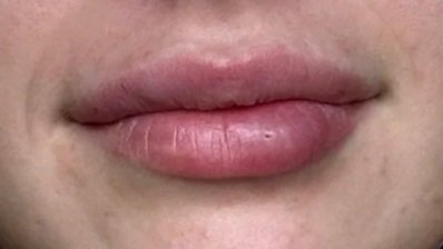 Close-up of a person's lips and surrounding skin.