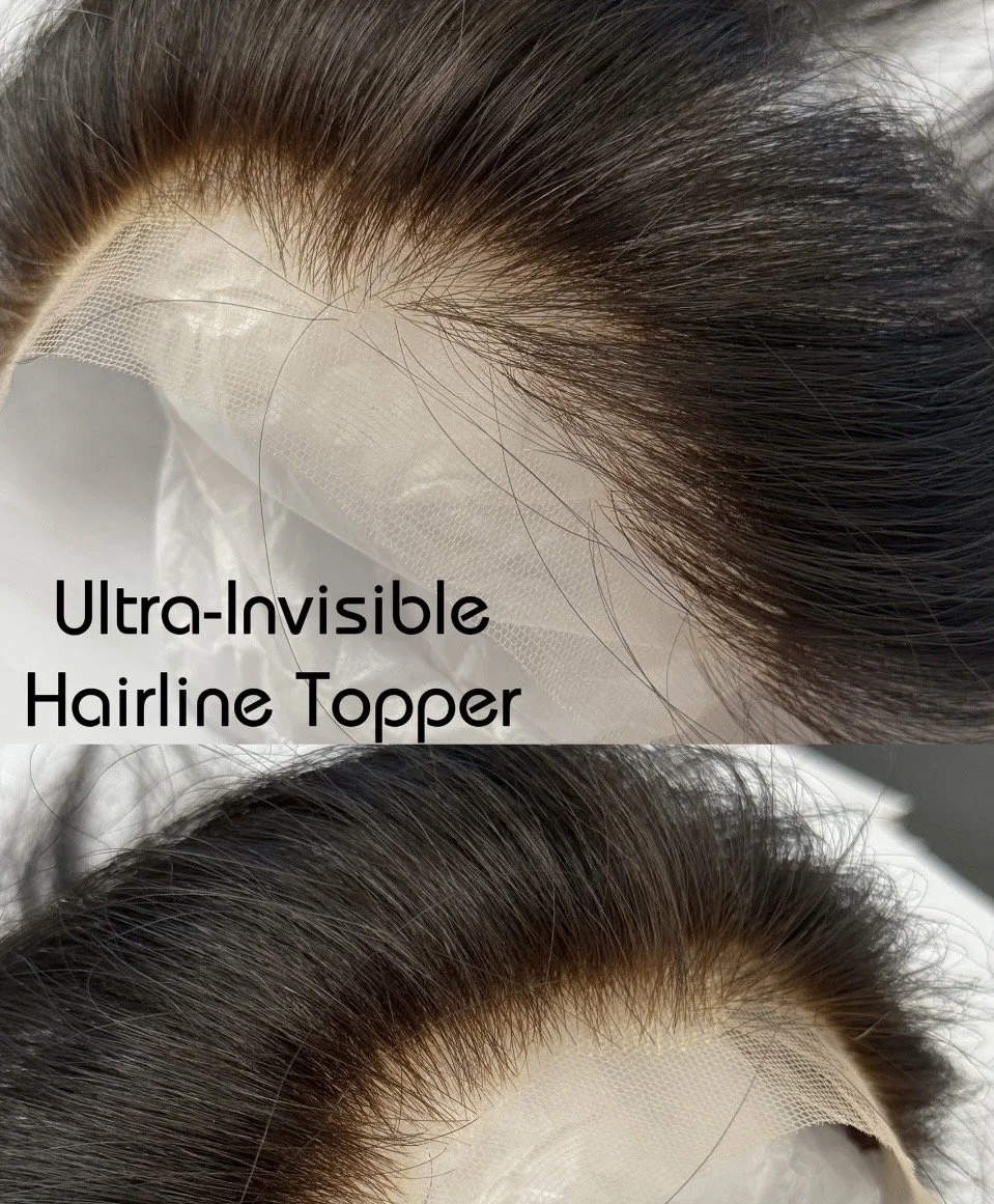 Close-up of a hairline frontal medical grade premium raw human hai with an ultra-invisible hairline topper applied, showing natural-looking hair growth and seamless blend.