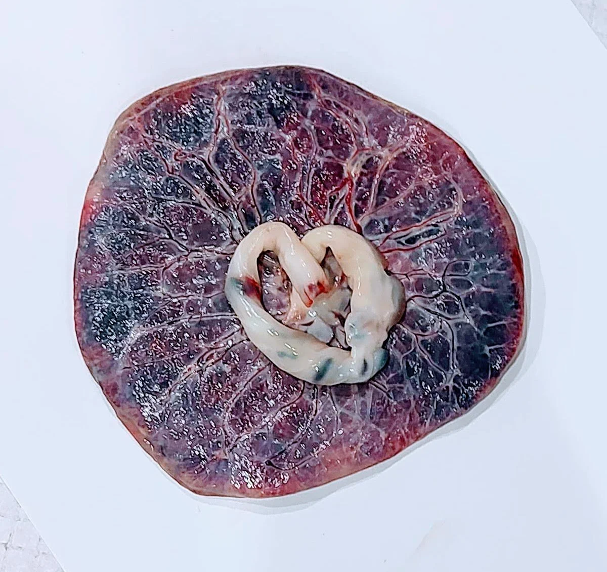 Placenta Joy - Wow Wednesday series 1