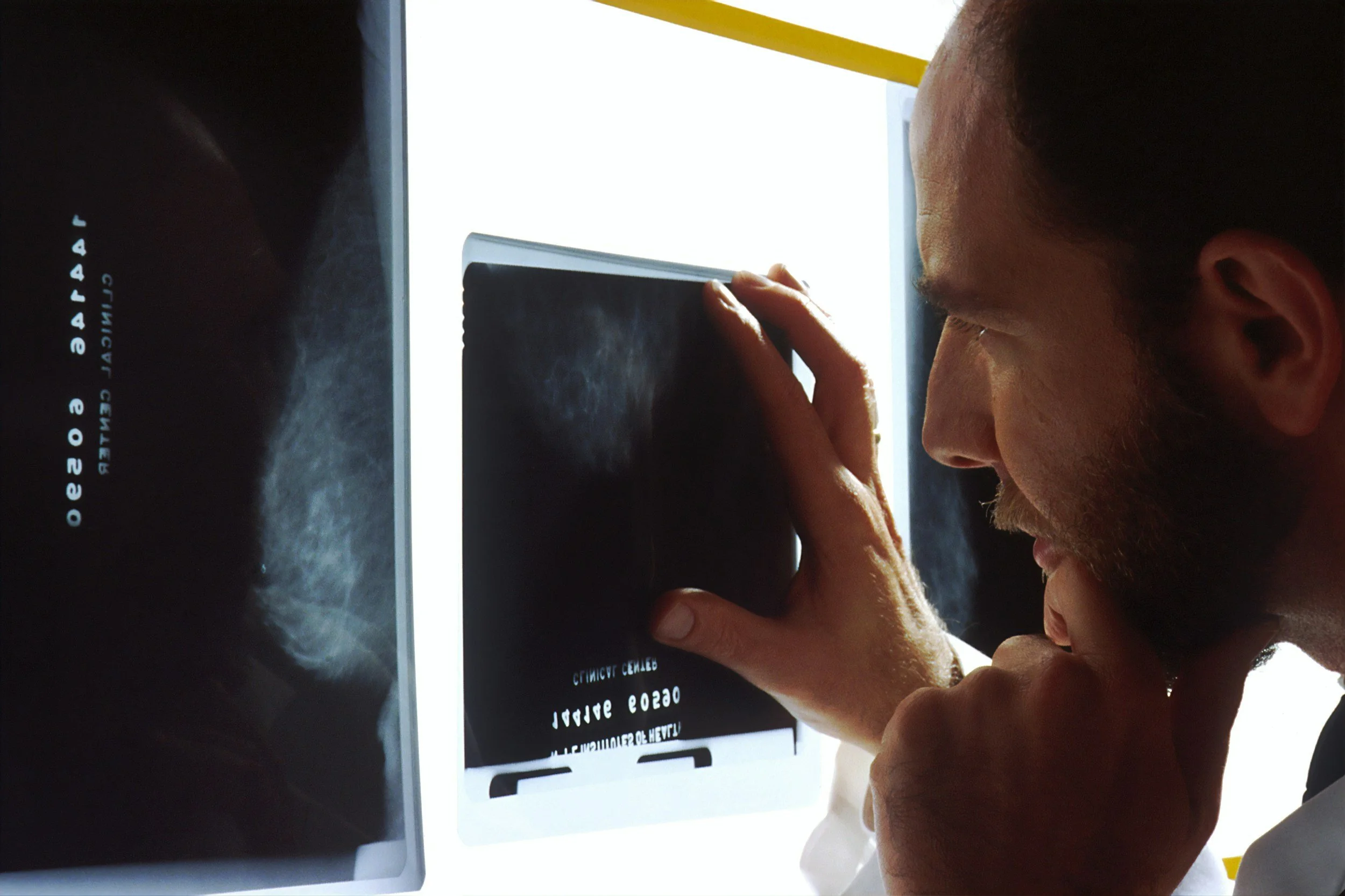 A man examining a chest X-ray film in a medical setting, with another X-ray image visible on a lightbox in the background.