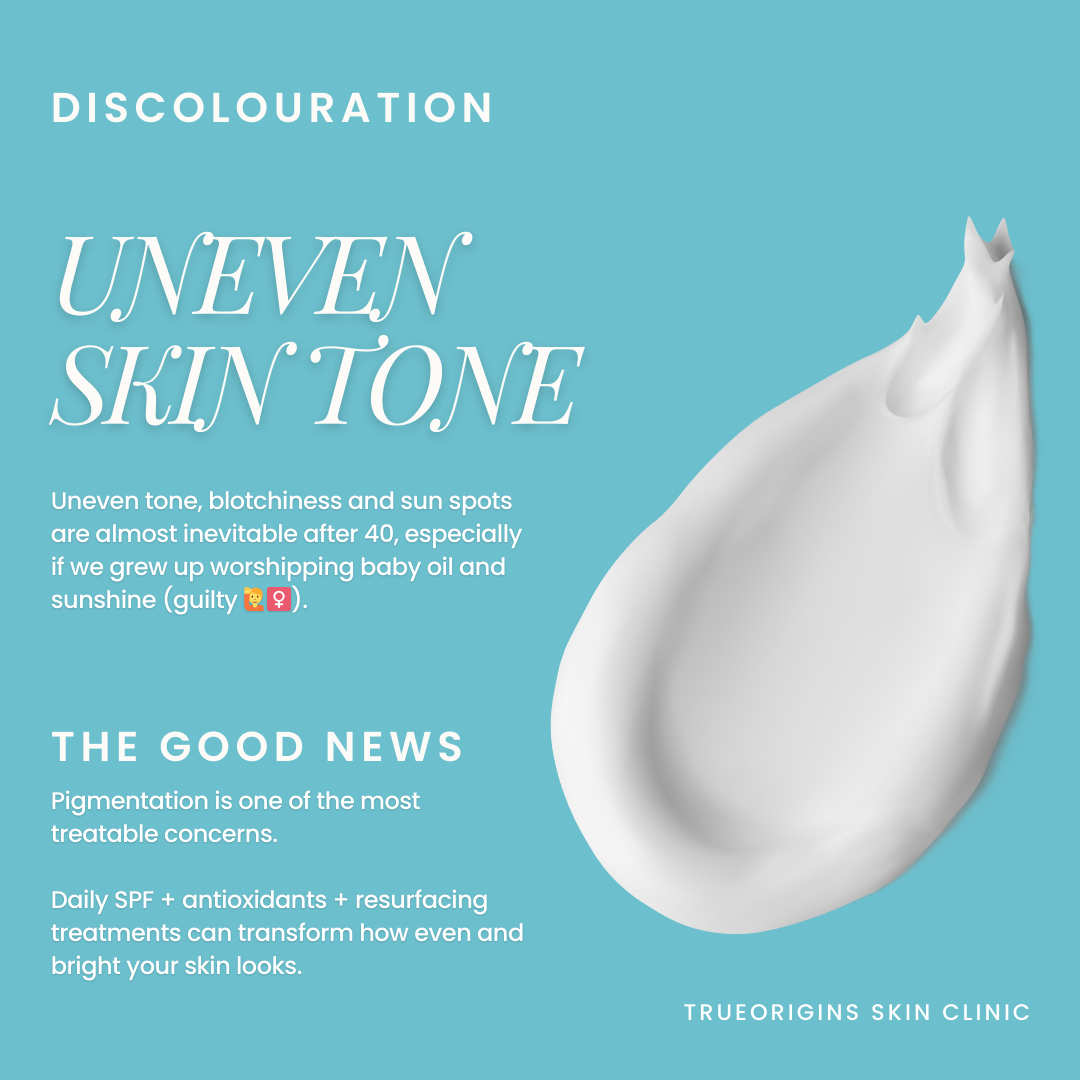 Advertisement about uneven skin tone and discoloration, with an image of a dollop of skincare cream on a blue background.