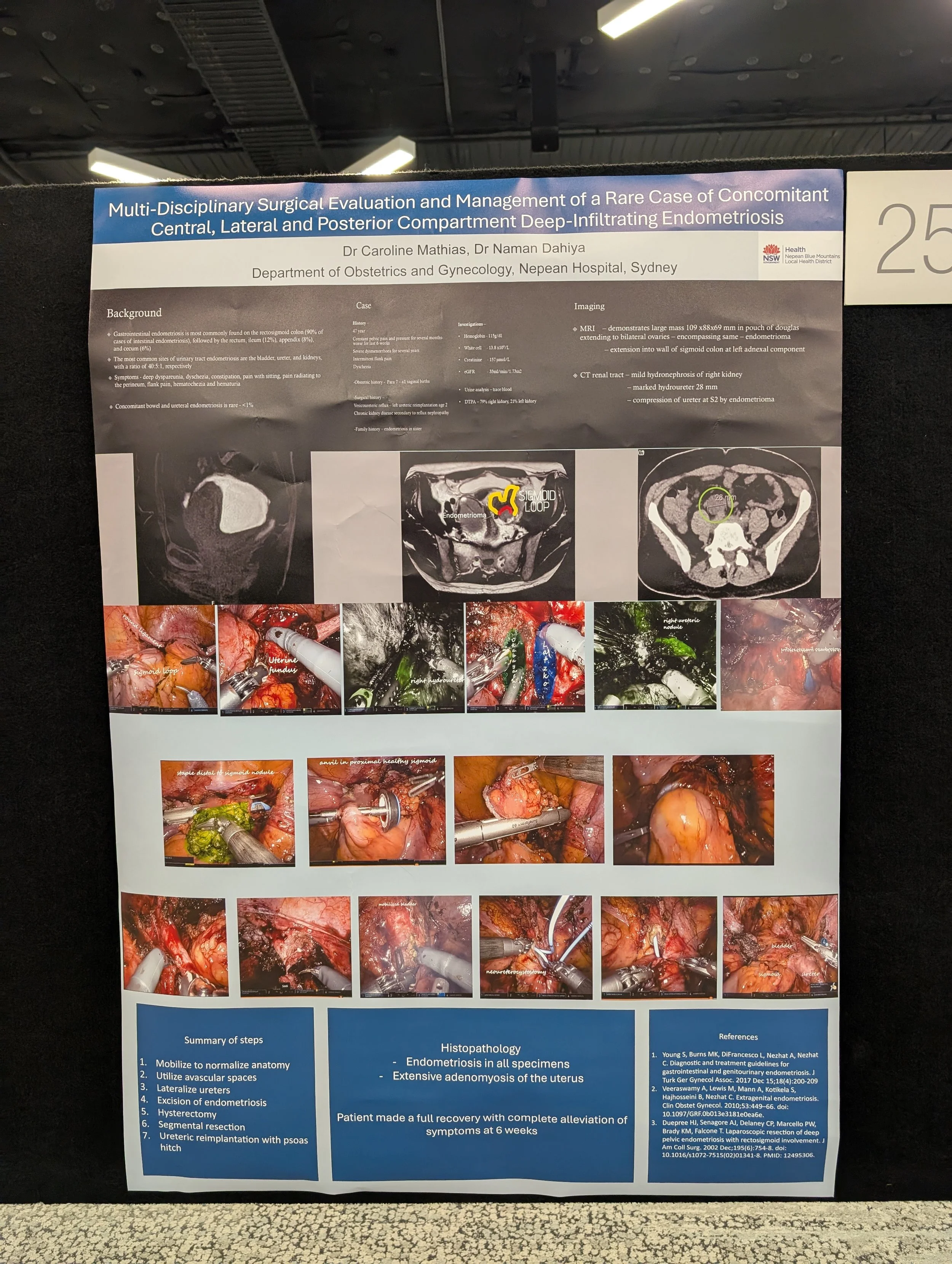 World Endometriosis Society Congress