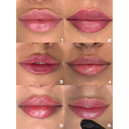 BreNova Wellness  Medspa in Elm Grove, WI, 53122  Botox, Fillers, GLP-1