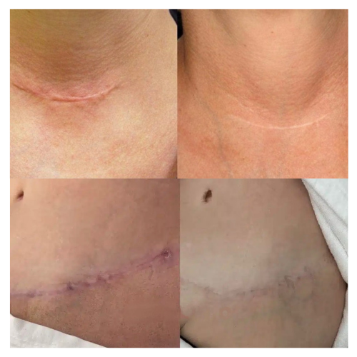 BreNova Wellness  Medspa in Elm Grove, WI, 53122  Botox, Fillers, GLP-1