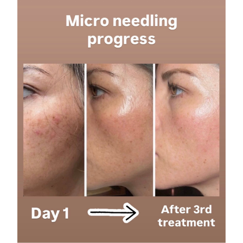 BreNova Wellness  Medspa in Elm Grove, WI, 53122  Botox, Fillers, GLP-1