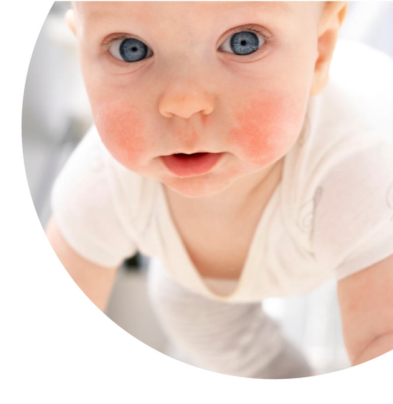 Brisbane Kids Allergist Children's Allergy Specialist Dr Sophie Willcocks