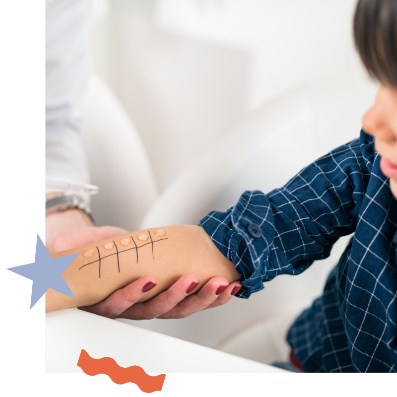 Skin Prick Testing Intradermal Testing Brisbane Dr Sophie Willcocks