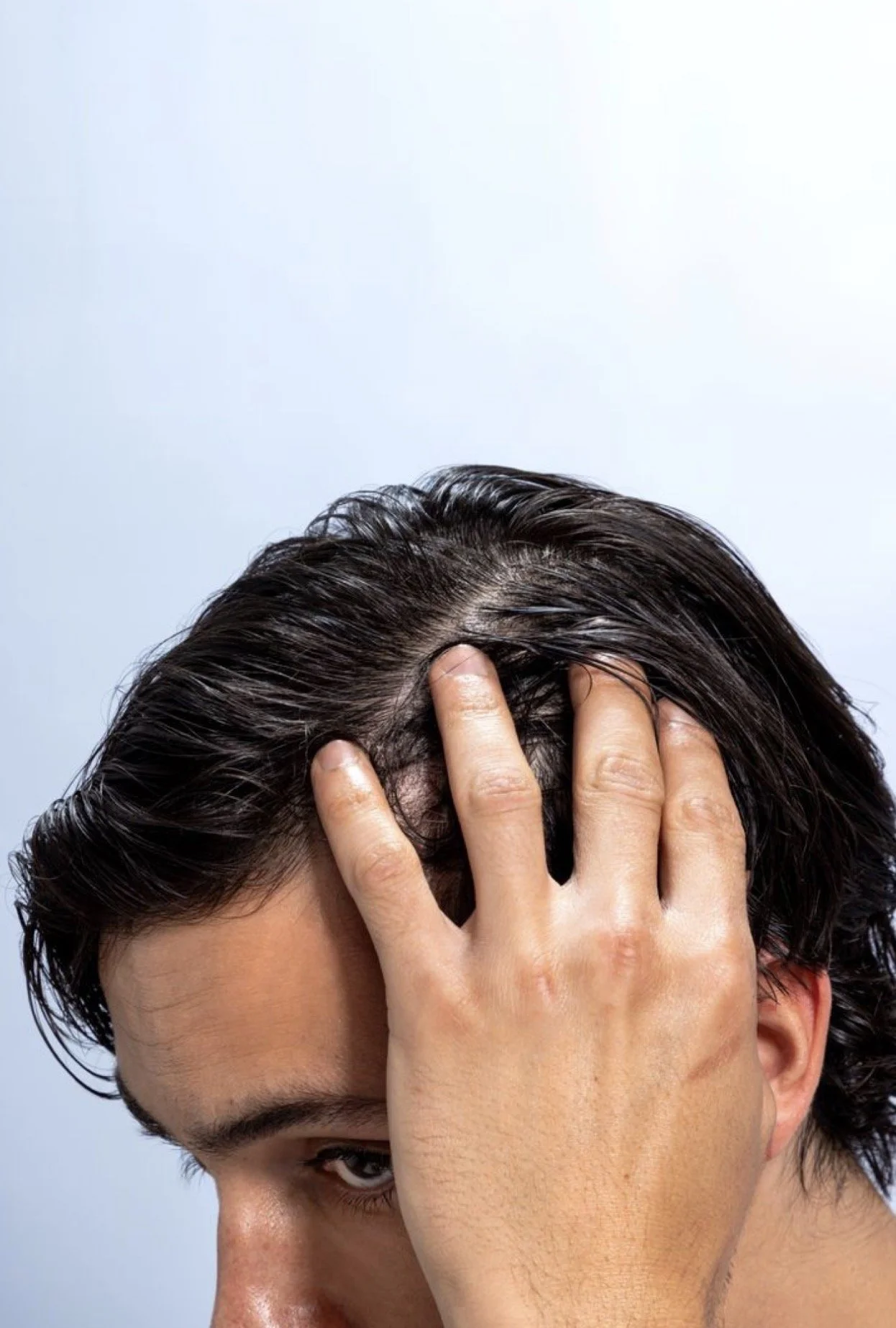 Person holding wet hair back showing scalp:
PRF Hair Restoration treatment Brisbane | Scalp health and hair thinning treatment Dose Clinic West End