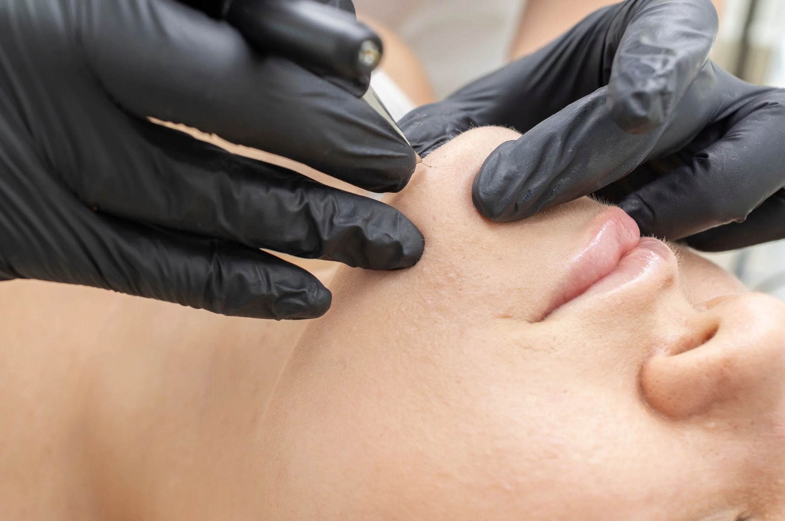 Electrolysis