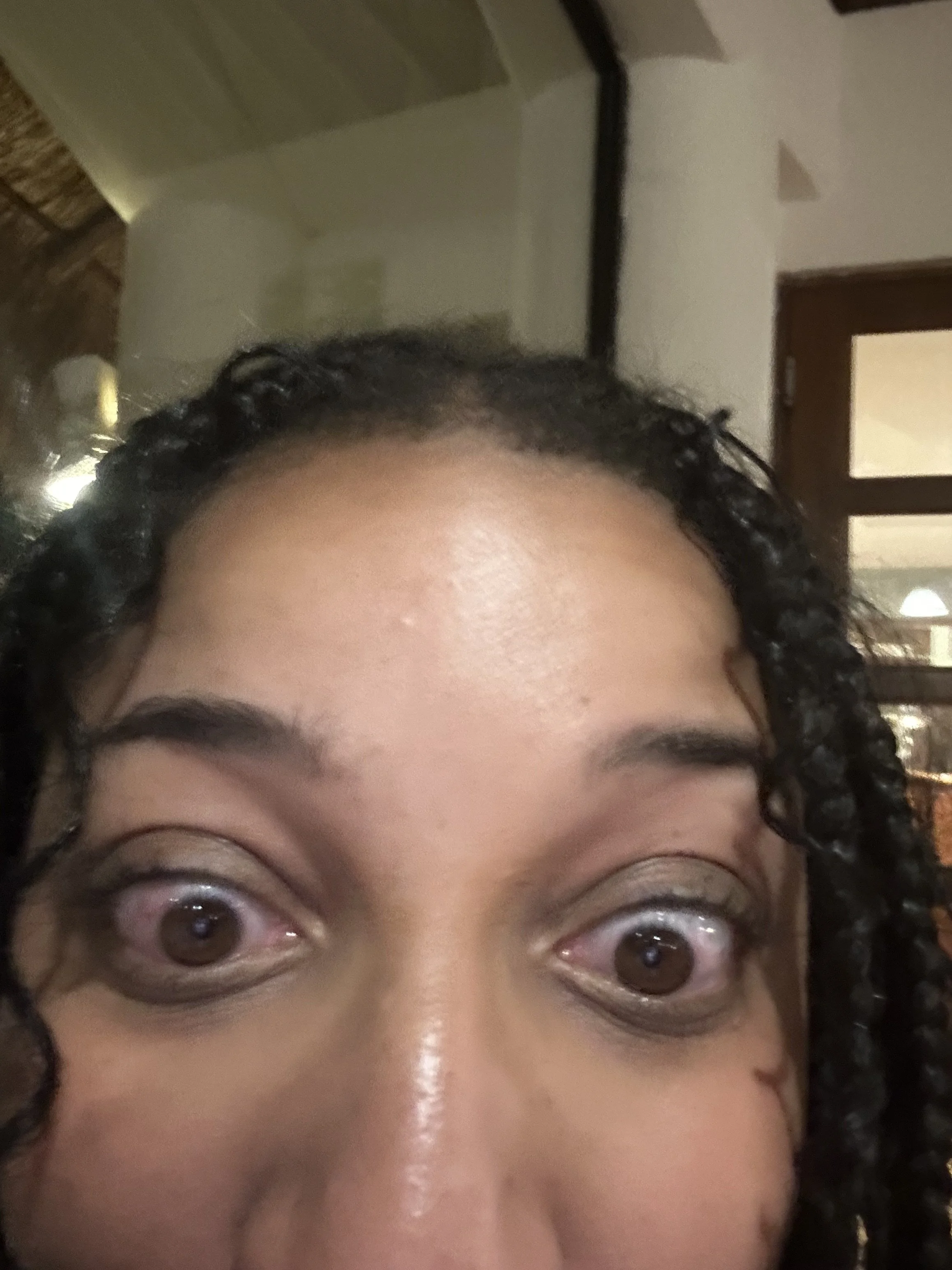 Getting an eye infection in Cancun
