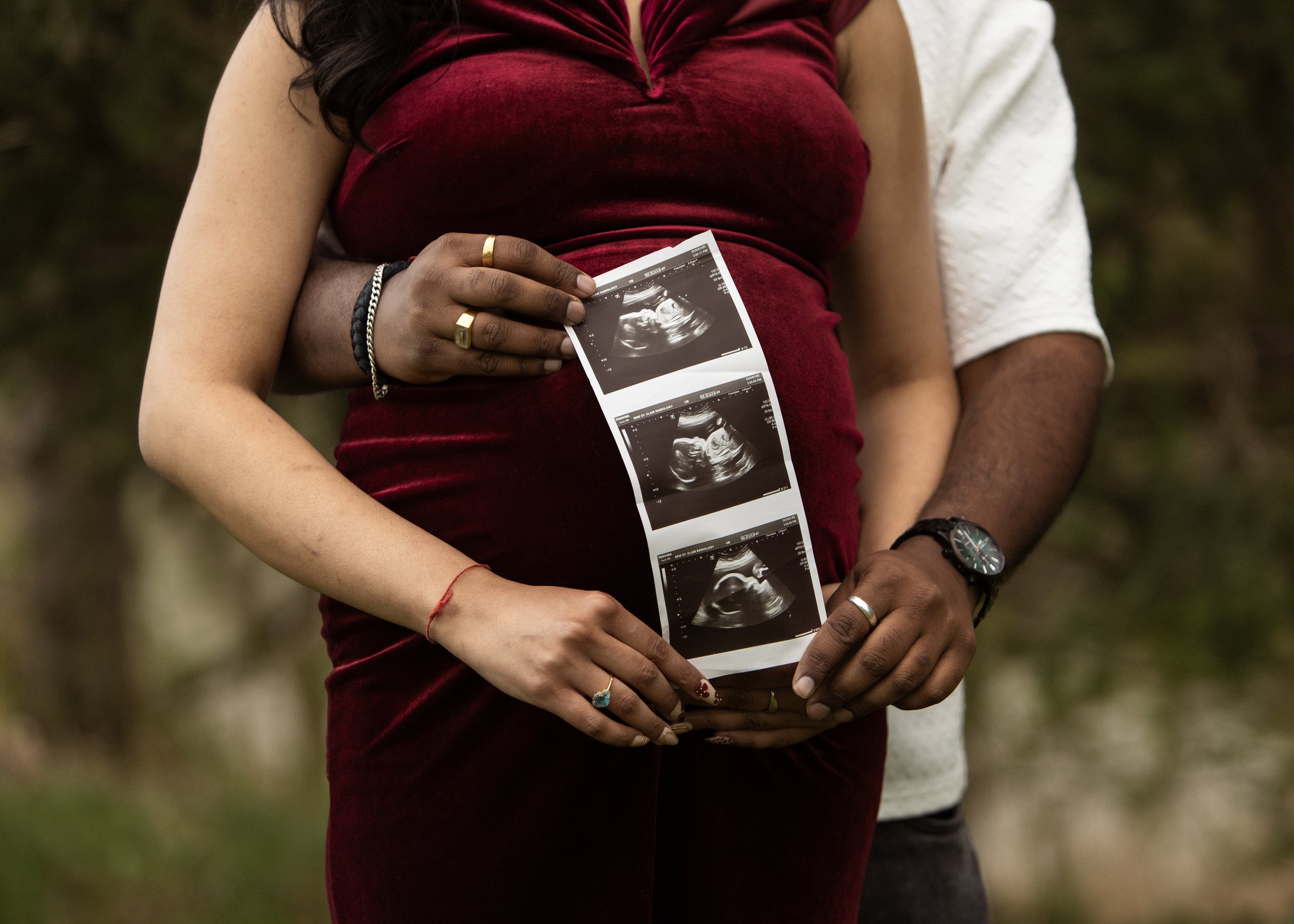 Couple holding ultrasound sonogram picture, standing outdoors with greenery background. Focus on their hands and the ultrasound photo.