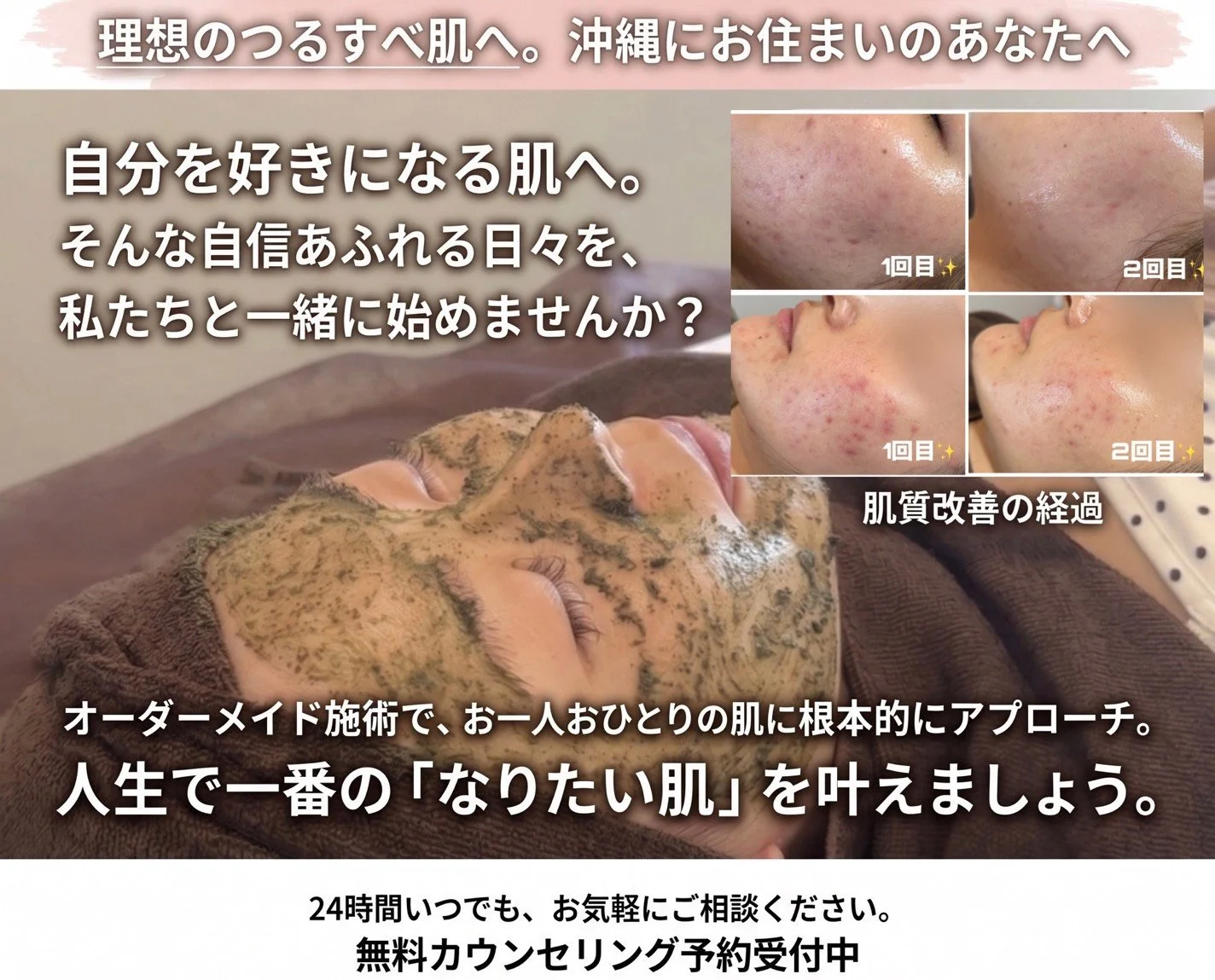 名護市印象管理専門エステClassy＆TrueMeハーブピーリングと毛穴洗浄（ハイドラ）で肌質を整えのエステ施術とビフォーアフターの肌写真の広告。
※イメージ画像

綺麗になっていく効果には個人差があります。