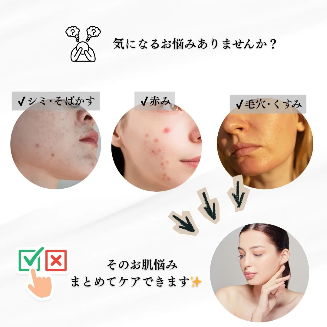 その肌悩み、
隠し続けるのはもう終わり✨

「ファンデで隠しても隠しきれない😢」
「最近、肌の元気がなくなってきた気がする💦」
それ、お肌の奥の
&ldquo;サボり&rdquo;が原因です😭

フォトフェイシャルは
特殊な光をお肌に当てることで
眠っていたコラーゲンを
呼び覚ます施術です🌿

✔ シミ・そばかすが気になる
✔ お肌のくすみを飛ばしたい
✔ ハリを出して若々しくいたい

一つでも当てはまるなら
「フォト」がオススメ🌷

光を当てるだけで
お肌のトーンがパッと明るくなりま