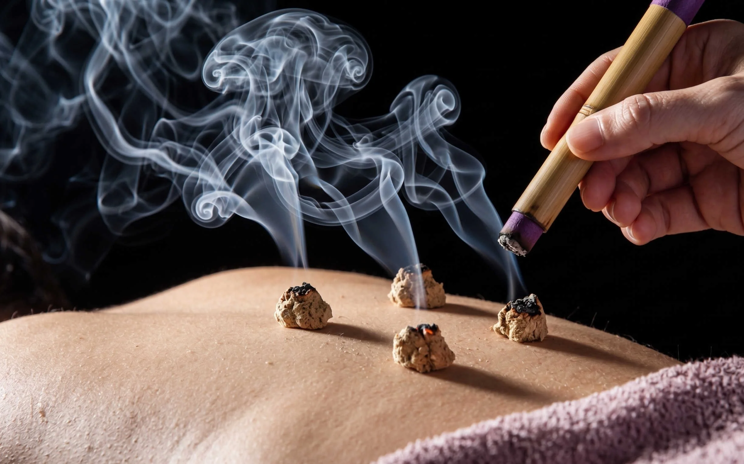 Reinhabit acupuncture Lichfield - a patient receiving a moxibustion therapy