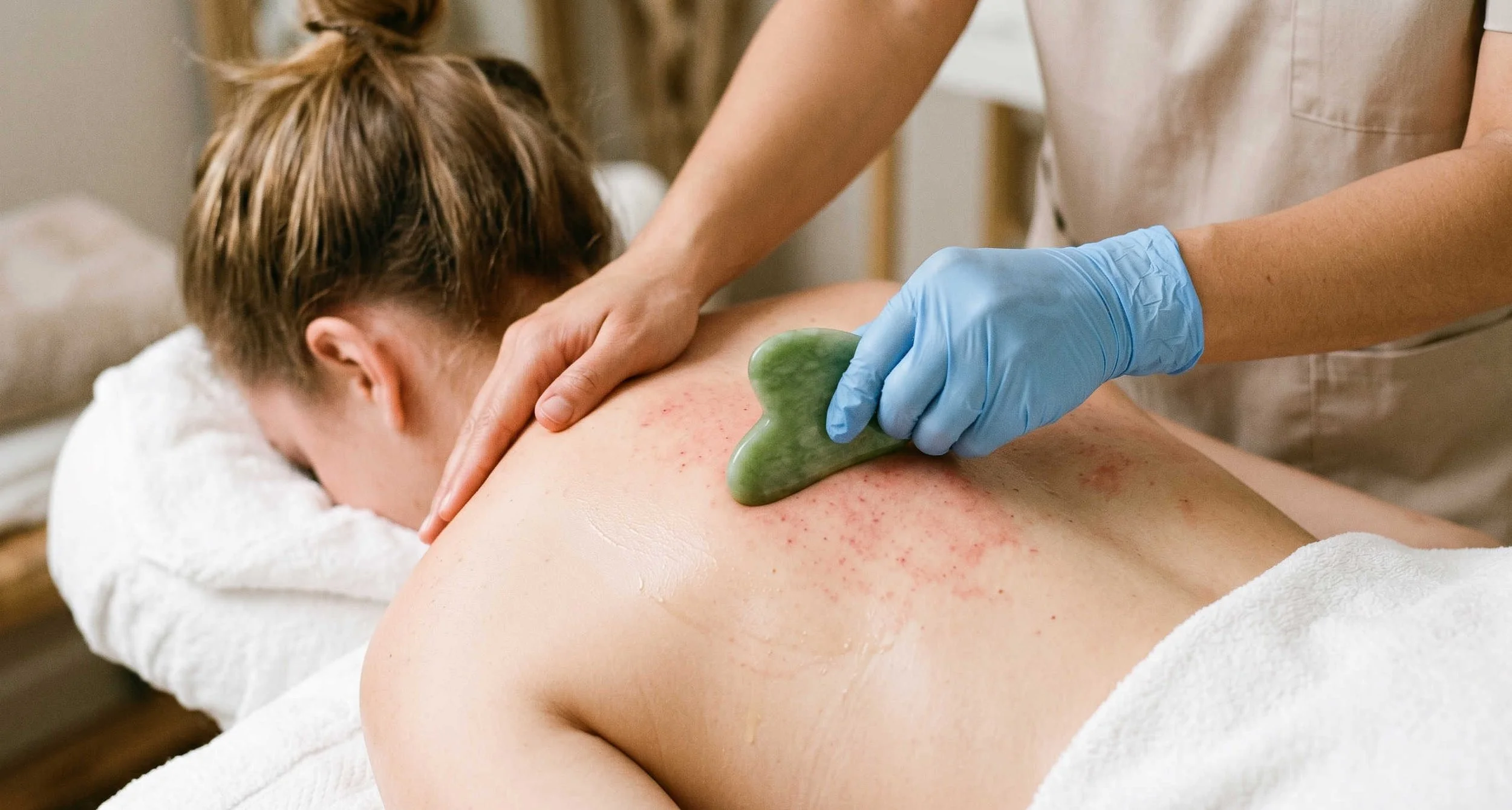 Reinhabit acupuncture Lichfield: a female patient under a Gua Sha therapy