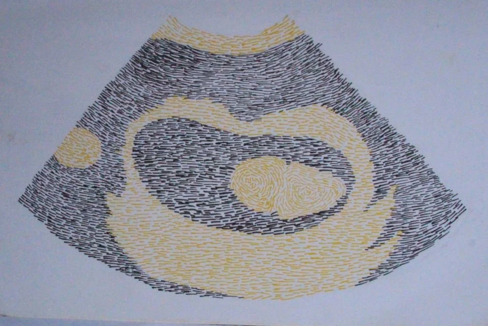 Title: Lil Honeybee:

Lil Honeybee continues the therapeutic, obsessive mark-making process of Diary of a Pregnant “Woman”. Using yellow and black, the piece traces over the first sonogram of my child—then just a tiny, indistinct form. Choosing to ke